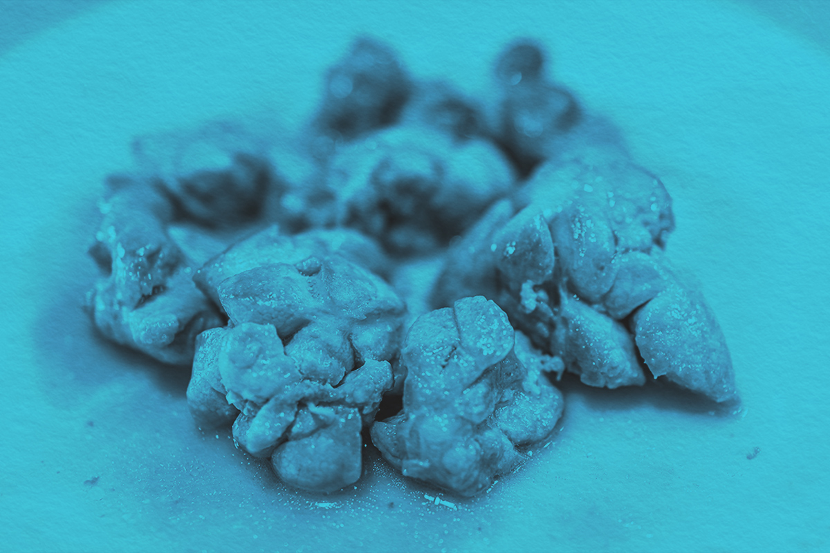 Why Is Sweetbread Neither Sweet Nor Bread?